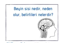 Beyin sisi
